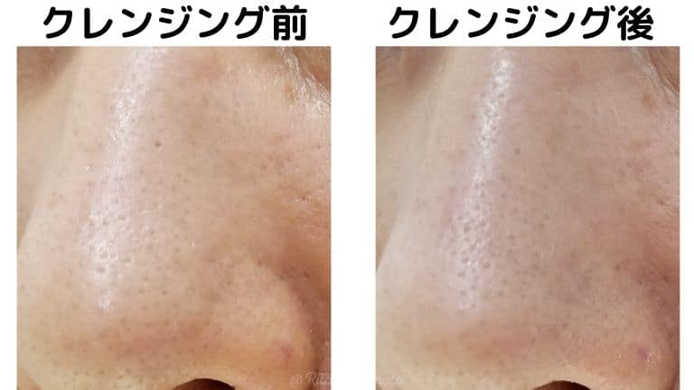 リダーマラボクレンジング毛穴変化 (1)