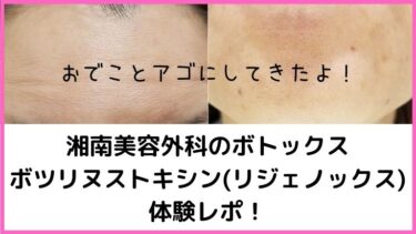 湘南美容外科のリジェノックスで韓国産ボトックスをしてきた体験レポ！施術前からのビフォアフ公開します！
