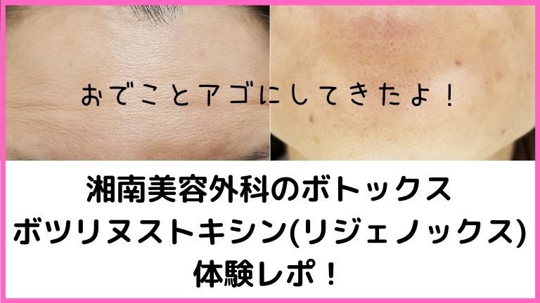 湘南リジェノックス体験レポアイキャッチ (1)