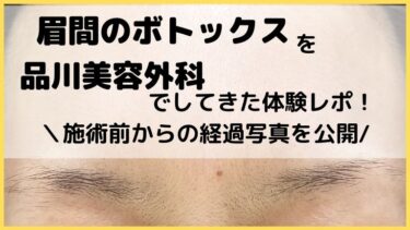 眉間のボトックスを品川美容外科でしてきた体験レポ！施術前からのシワ消滅までの写真公開します！