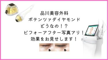 品川美容外科でポテンツァダイヤモンドチップをした口コミ！効果をビフォーアフター写真でお見せします！