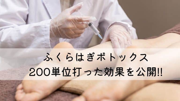 ふくらはぎボトックスアイキャッチ